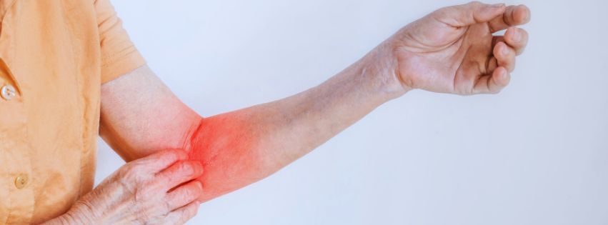 fungal infection on skin