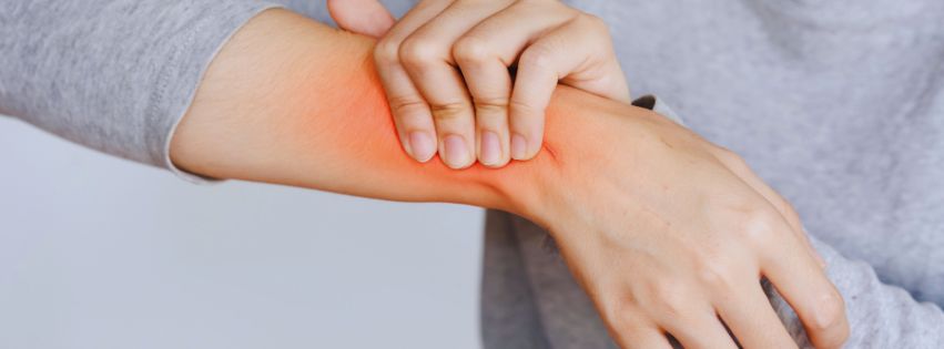 inflamed skin