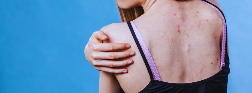 red bumps on arms